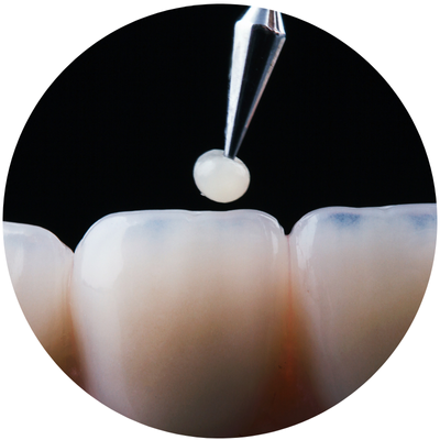 Restauração Dentária - Dra. Karina Caciano